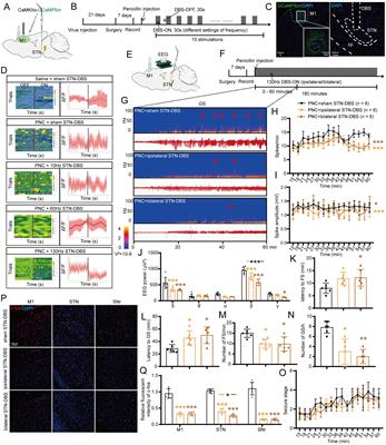 Subthalamic nucleus stimulation attenuates motor seizures via modulating the nigral orexin pathway